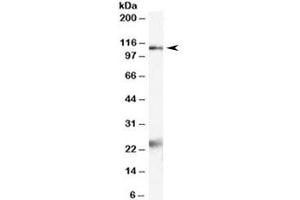 Western blot testing of rat brain lysate with NR1 antibody at 2ug/ml. (GRIN1/NMDAR1 anticorps)