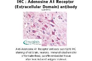 Image no. 1 for anti-Adenosine A1 Receptor (ADORA1) (2nd Extracellular Domain) antibody (ABIN1731548)