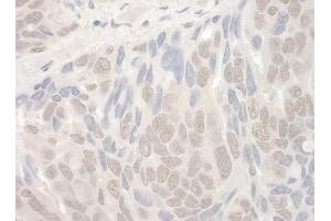 anti-THO Complex 2 (THOC2) (AA 1400-1450) antibody