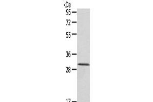 Western Blot analysis of A431 cells using HTATIP2 Polyclonal Antibody at dilution of 1/800 (HIV-1 Tat Interactive Protein 2, 30kDa (HTATIP2) anticorps)