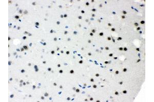 Anti- SNRPN Picoband antibody, IHC(P) IHC(P): Mouse Brain Tissue