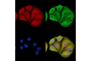 ABIN7094940 and ABIN7098996 staining  cells by IF/ICC.