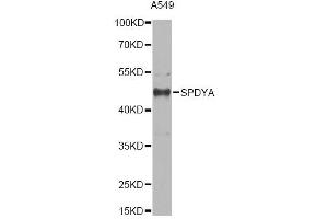 Western blot analysis of extracts of A549 cells, using SPDYA antibody.