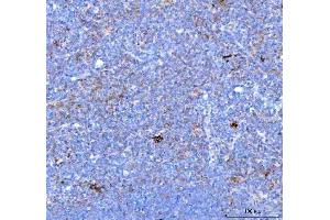 IHC analysis of PDCD1 using anti PDCD1 antibody (ABIN5518784). (PD-1 anticorps  (N-Term))