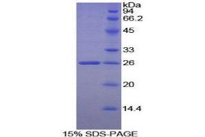 SDS-PAGE (SDS) image for Heparanase (HPSE) (AA 54-278) protein (His tag) (ABIN2121226) (HPSE Protein (AA 54-278) (His tag))