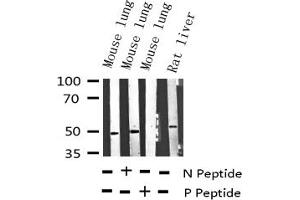 Western blot analysis of Phospho-VASP (Ser157) expression in various lysates (VASP anticorps  (pSer157))