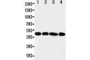 Anti-IL3RA antibody, Western blotting Lane 1: A431 Cell Lysate Lane 2: SMMC Cell Lysate Lane 3: U87 Cell Lysate Lane 4: 293T Cell Lysate (IL3RA anticorps  (Middle Region))
