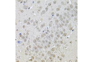 Immunohistochemistry of paraffin-embedded mouse brain using DR1 Antibody (ABIN5975441) at dilution of 1/100 (40x lens).