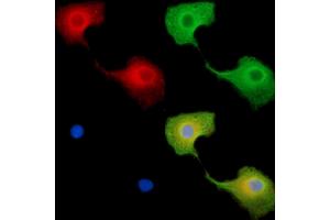 ABIN7096228 and ABIN7100290 staining  cells by IF/ICC. (BTBD8 anticorps)