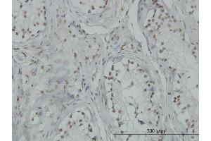 Immunoperoxidase of monoclonal antibody to TP53BP2 on formalin-fixed paraffin-embedded human testis.