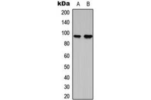 Western blot analysis of G15 expression in RT4 (A), NIH3T3 (B) whole cell lysates. (AGPAT1 anticorps  (Center))
