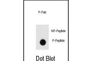 Dot blot analysis of anti-Phospho-Endophilin-pY80 Pab (ABIN650823 and ABIN2839797) on nitrocellulose membrane. (Endophilin (pTyr80) anticorps)