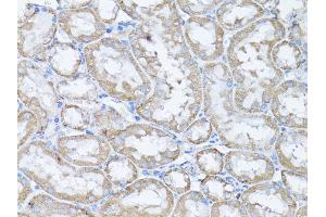 Immunohistochemistry of paraffin-embedded rat kidney using SNAI1 antibody. (SNAIL anticorps)