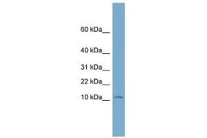 NOLA3 antibody used at 1 ug/ml to detect target protein. (Nop10 anticorps  (Middle Region))