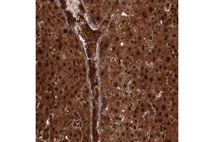 Immunohistochemical staining of human liver with FTSJ1 polyclonal antibody  shows strong nuclear and cytoplasmic positivity in hepatocytes and extracellular positivity in blood vessels . (FTSJ1 anticorps)