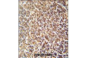 ZNF98 antibody immunohistochemistry analysis in formalin fixed and paraffin embedded human lymphnode followed by peroxidase conjugation of the secondary antibody and DAB staining.