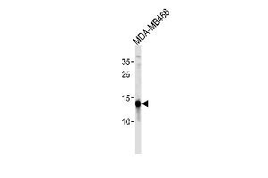 TPD52L3 Antibody (N-term) (ABIN1881899 and ABIN2843497) western blot analysis in MDA-M cell line lysates (35 μg/lane). (TPD52L3 anticorps  (N-Term))