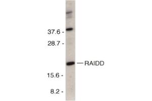 Image no. 2 for anti-CASP2 and RIPK1 Domain Containing Adaptor with Death Domain (CRADD) (C-Term) antibody (ABIN201312) (CRADD anticorps  (C-Term))