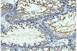 IHC analysis of GIT1 using anti-GIT1 antibody (ABIN7601683). (GIT1 anticorps  (AA 415-736))