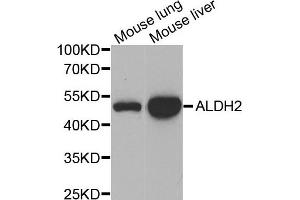 Western blot analysis of extracts of mouse lung and mouse liver  tissues, using ALDH2 antibody. (ALDH2 anticorps)