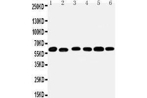 Anti-Monoamine Oxidase B antibody, Western blotting Lane 1: Mouse Liver Tissue Lysate Lane 2: Mouse Lung Tissue Lysate Lane 3: Rat Kidney Tissue Lysate Lane 4: Rat Brain Tissue Lysate Lane 5: Rat Liver Tissue Lysate Lane 6: Rat Lung Tissue Lysate (Monoamine Oxidase B anticorps  (N-Term))