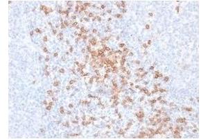 ABIN6383871 to CD8a was successfully used to stain T cells of in human tonsil sections. (Recombinant CD8 alpha anticorps)