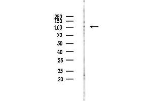 anti-Upregulator of Cell Proliferation (URGCP) antibody