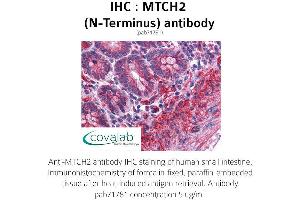 Image no. 1 for anti-Mitochondrial Carrier 2 (MTCH2) (N-Term) antibody (ABIN1737107) (MTCH2 anticorps  (N-Term))