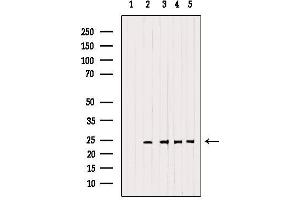 Western blot analysis of extracts from various samples, using RAB14 Antibody. (RAB14 anticorps  (C-Term))
