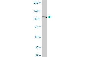 HIP1R MaxPab rabbit polyclonal antibody. (HIP1R anticorps  (AA 1-1068))