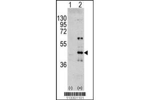 Western blot analysis of MAPK3 using rabbit polyclonal MAPK3 Antibody (Y204) using 293 cell lysates (2 ug/lane) either nontransfected (Lane 1) or transiently transfected with the MAPK3 gene (Lane 2). (ERK1 anticorps  (AA 182-211))