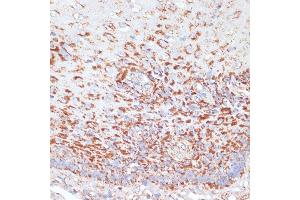 Immunohistochemistry of paraffin-embedded human esophageal using MRPL46 antibody (ABIN7268574) at dilution of 1:100 (40x lens).