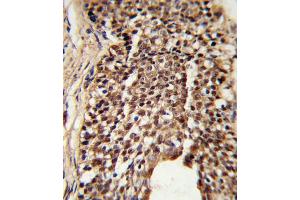 Immunohistochemistry (IHC) image for anti-Triosephosphate Isomerase 1 (TPI1) antibody (ABIN3001712)