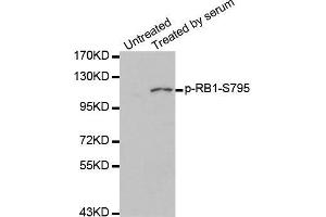 Western blot analysis of extracts of 293 cell line, using phospho-RB-S795 antibody. (Retinoblastoma 1 anticorps  (pSer795))