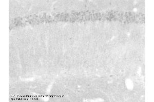 Immunohistochemistry with Small intestine tissue at an antibody concentration of 5µg/ml using anti-PSEN1 antibody (ARP58941_P050)