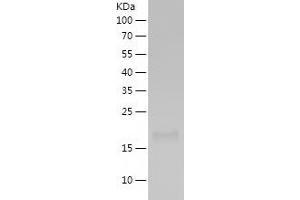 Western Blotting (WB) image for TNF Receptor Superfamily, Member 6 (FAS) (AA 17-173) protein (His tag) (ABIN7125404)