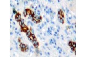 Used in DAB staining on fromalin fixed paraffin-embedded Liver tissue (NUMB anticorps  (AA 377-642))