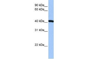 WB Suggested Anti-FTSJ1 Antibody Titration:  0. (FTSJ1 anticorps  (N-Term))