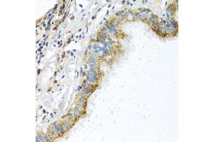 Immunohistochemistry of paraffin-embedded human trachea using ATPIF1 antibody (ABIN5972942) at dilution of 1/100 (40x lens). (ATPase Inhibitory Factor 1 anticorps)