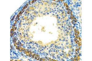 Immunohistochemistry of paraffin-embedded Rat ovary using MRPL28 Polyclonal Antibody at dilution of 1:100 (40x lens). (MRPL28 anticorps)