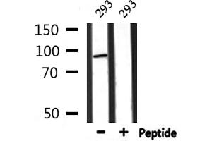 Western blot analysis of extracts from 293, using MASTL Antibody. (MASTL anticorps  (C-Term))