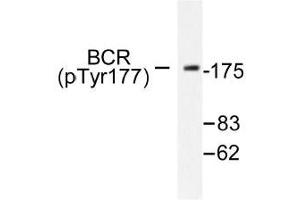 Image no. 1 for anti-Breakpoint Cluster Region (BCR) (pTyr177) antibody (ABIN317974) (BCR anticorps  (pTyr177))