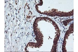 Image no. 5 for anti-Cytochrome P450, Family 2, Subfamily A, Polypeptide 6 (CYP2A6) antibody (ABIN1497724)