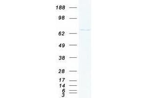 Validation with Western Blot