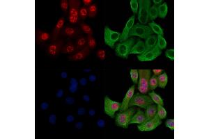 Phospho-Histone H3 (Thr3) Antibody staining Hela cells(heat shock treatment) by IF/ICC. (Histone 3 anticorps  (H3T3ph))
