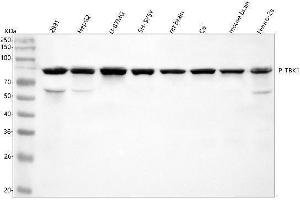 Western blot analysis of NAK/TBK1 using anti-NAK/TBK1 antibody (ABIN7603280).