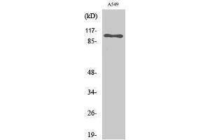 Western Blotting (WB) image for anti-Sodium Potassium ATPase, alpha1 (ATP1A1) (Ser16) antibody (ABIN3185758) (ATP1A1 anticorps  (Ser16))