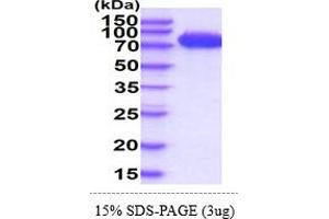 SDS-PAGE (SDS) image for Melanoma Cell Adhesion Molecule (MCAM) (AA 24-559) protein (His tag) (ABIN5855057) (MCAM Protein (AA 24-559) (His tag))
