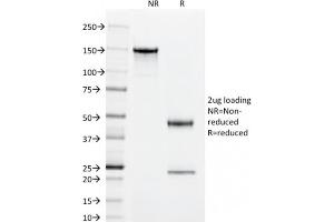 SDS-PAGE Analysis Purified CD55 Mouse Monoclonal Antibody (143-30).