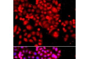 Immunofluorescence analysis of A549 cells using ASCC3 Polyclonal Antibody (ASCC3 anticorps)